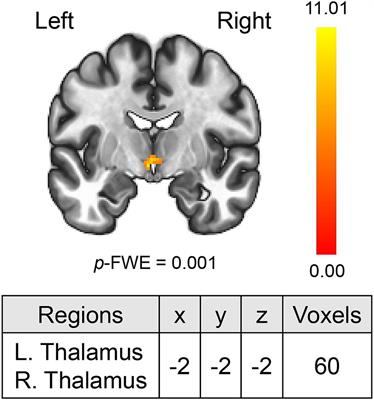 Individual cognitive therapy reduces frontal-thalamic resting-state functional connectivity in social anxiety disorder
